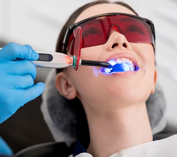 How Much Do Teeth Veneers Cost